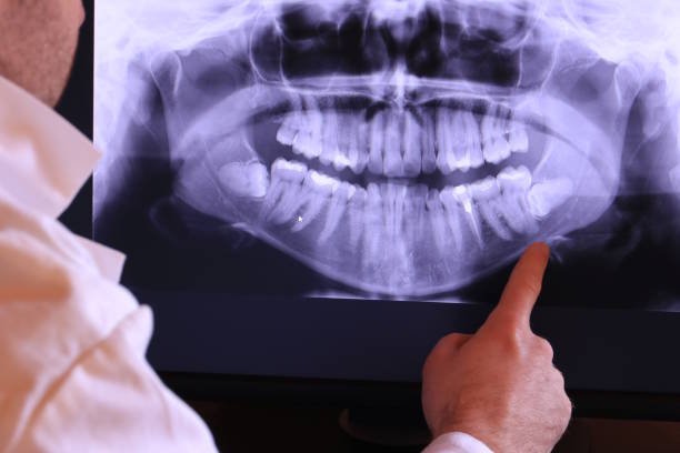 Best Weekend Emergency Dentist in Mount Olive, AL